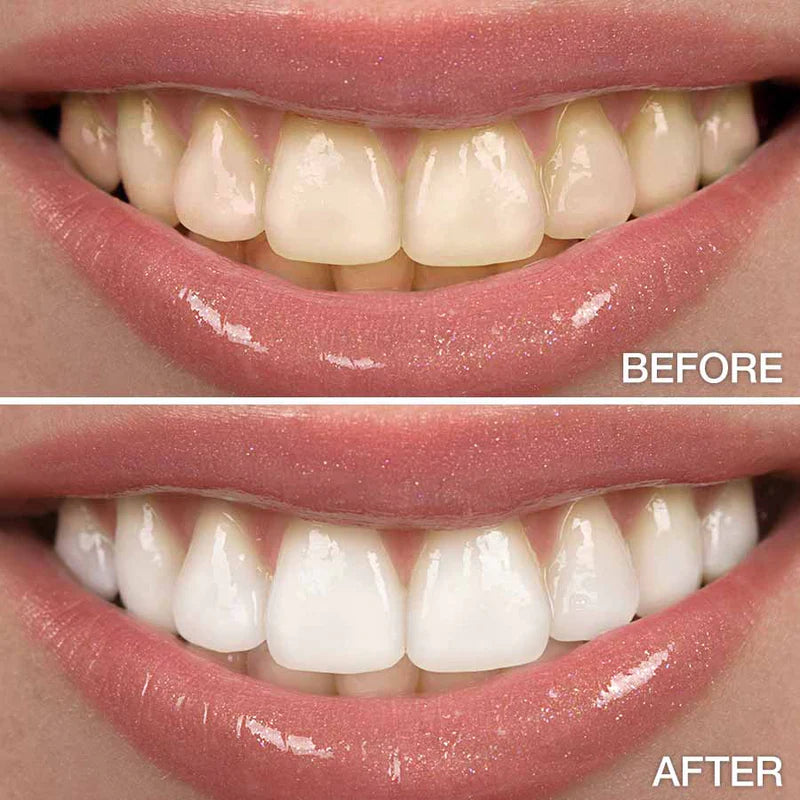 Crest® 3D Whitestrips™ Supreme Bright - Teeth Whitening Strips