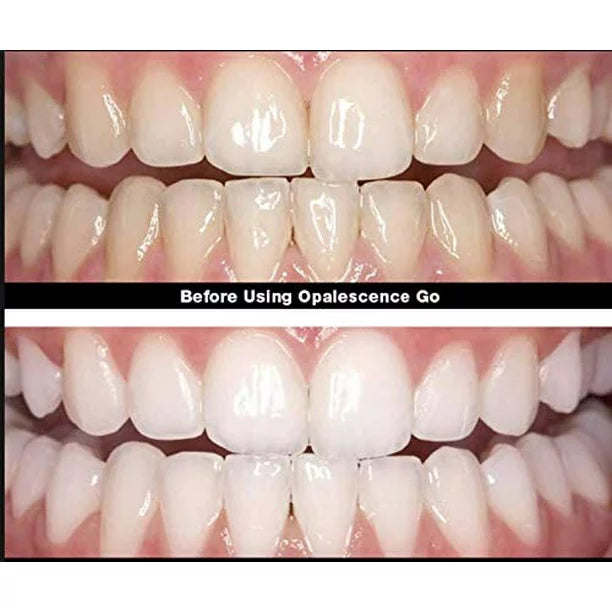 Opalescence Go™ Teeth Whitening Treatment - 15% Hydrogen Peroxide, Mint Flavor